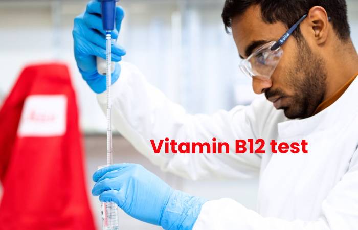 Vitamin B12 test