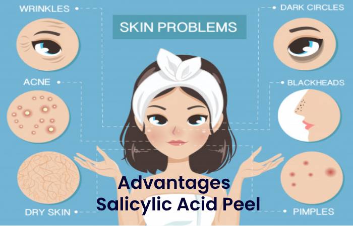 Advantages Salicylic Acid Peel