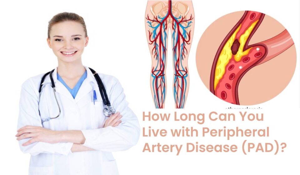 Peripheral Artery Disease and its treatment